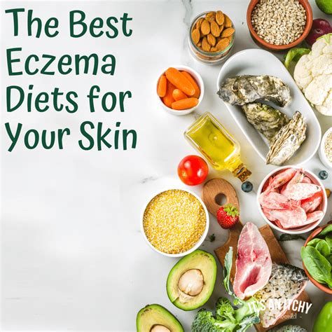 What Cause Eczema Food