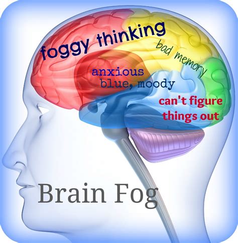 What To Do If Your Brain Feels Foggy And Forgetful